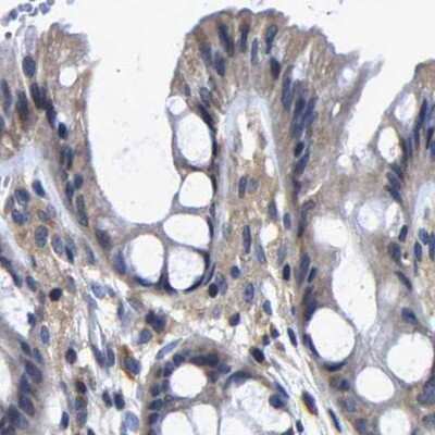 Immunohistochemistry-Paraffin: CCDC6 Antibody [NBP1-85351]