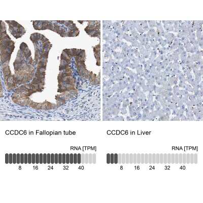 Immunohistochemistry-Paraffin: CCDC6 Antibody [NBP1-85351]