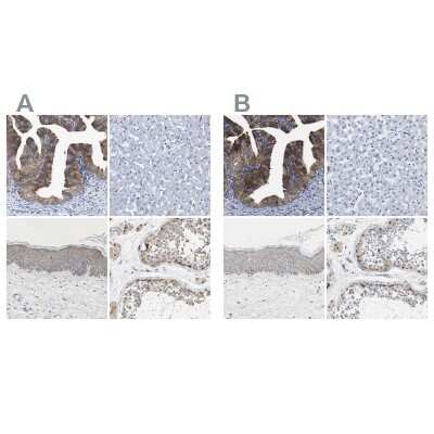 Immunohistochemistry-Paraffin: CCDC6 Antibody [NBP1-85351]