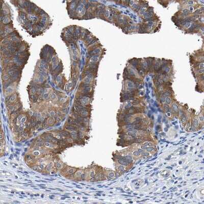 Immunohistochemistry-Paraffin: CCDC6 Antibody [NBP1-85351]