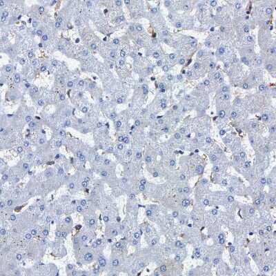 Immunohistochemistry-Paraffin: CCDC6 Antibody [NBP1-85351]