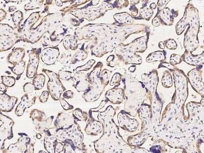 Immunohistochemistry-Paraffin: CCDC6 Antibody [NBP2-98985]