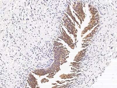 Immunohistochemistry-Paraffin: CCDC6 Antibody [NBP2-98985]