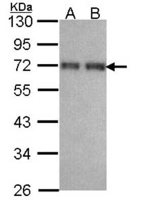 Western Blot: CCDC6 Antibody [NBP1-31882]