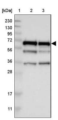 Western Blot: CCDC6 Antibody [NBP1-85351]