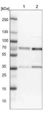 Western Blot: CCDC6 Antibody [NBP1-85351]