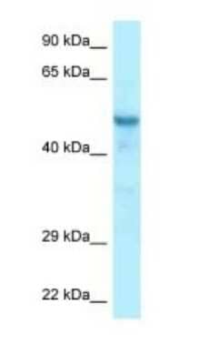 Western Blot: CCDC6 Antibody [NBP1-98370]