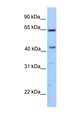 Western Blot: CCDC60 Antibody [NBP1-56747]