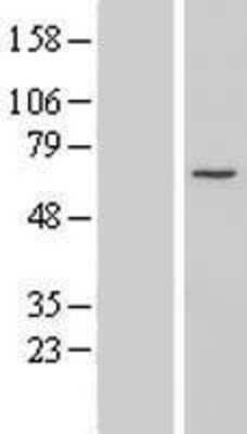 Western Blot: CCDC60 Overexpression Lysate [NBL1-08810]