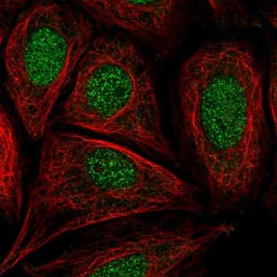 Immunocytochemistry/ Immunofluorescence: CCDC61 Antibody [NBP2-56560]