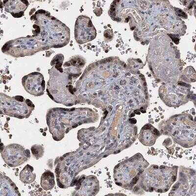 Immunohistochemistry-Paraffin: CCDC61 Antibody [NBP1-91134]