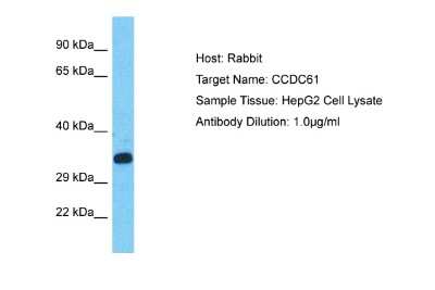 Western Blot: CCDC61 Antibody [NBP2-84616]