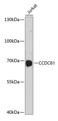 Western Blot: CCDC61 AntibodyBSA Free [NBP2-92014]