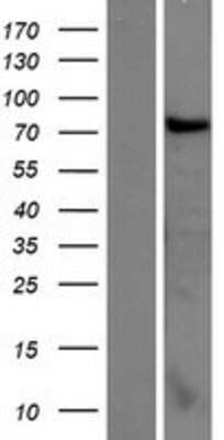 Western Blot: CCDC62 Overexpression Lysate [NBP2-05997]