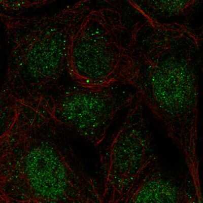 Immunocytochemistry/ Immunofluorescence: CCDC63 Antibody [NBP2-56562]