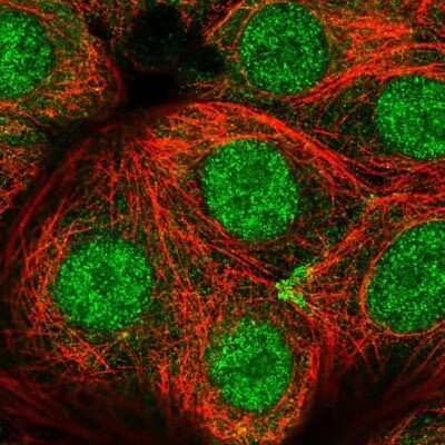 Immunocytochemistry/ Immunofluorescence: CCDC64 Antibody [NBP2-56736]