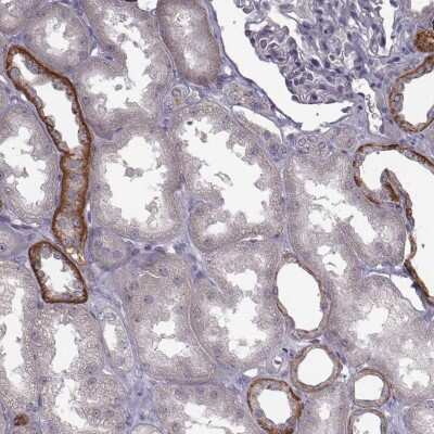 Immunohistochemistry-Paraffin: CCDC64 Antibody [NBP2-56736]