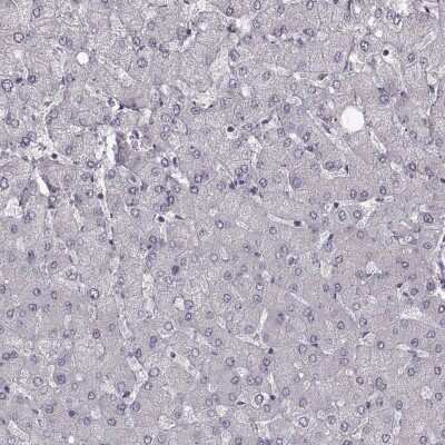 Immunohistochemistry-Paraffin: CCDC64 Antibody [NBP2-56736]
