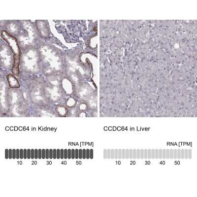 Immunohistochemistry-Paraffin: CCDC64 Antibody [NBP2-56736]