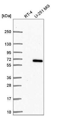 Western Blot: CCDC64 Antibody [NBP2-56736]