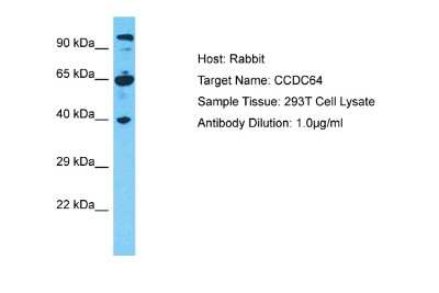 Western Blot: CCDC64 Antibody [NBP2-82607]