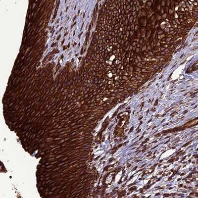 Immunohistochemistry-Paraffin: CCDC64B Antibody [NBP1-90963]
