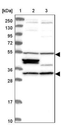 Western Blot: CCDC64B Antibody [NBP1-90963]