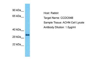 Western Blot: CCDC64B Antibody [NBP2-82608]