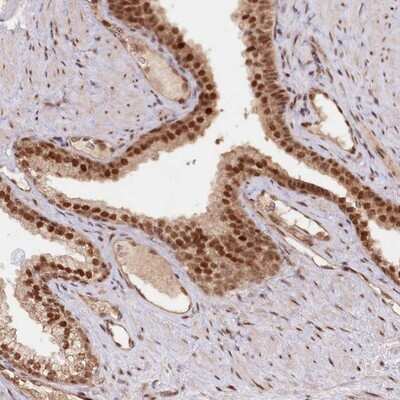 Immunohistochemistry-Paraffin: CCDC65 Antibody [NBP1-81968]