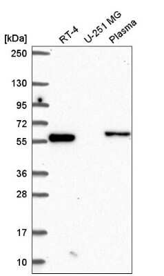 Western Blot: CCDC65 Antibody [NBP2-56860]