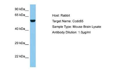 Western Blot: CCDC65 Antibody [NBP2-84617]