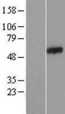 Western Blot: CCDC65 Overexpression Lysate [NBL1-08812]