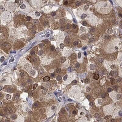 Immunohistochemistry-Paraffin: CCDC66 Antibody [NBP3-17163]