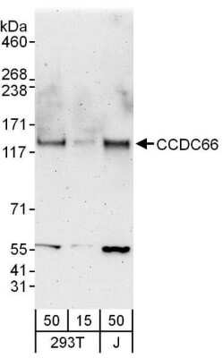 Western Blot: CCDC66 Antibody [NBP1-78739]