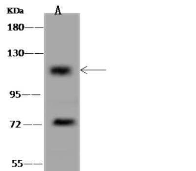 Western Blot: CCDC66 Antibody [NBP3-05878]