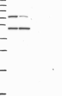 Western Blot: CCDC66 Antibody [NBP3-17163]