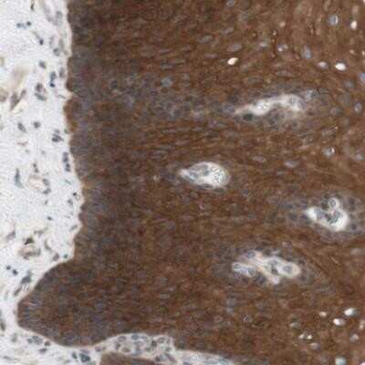 Immunohistochemistry-Paraffin: CCDC67 Antibody [NBP1-93920]