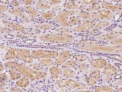 Immunohistochemistry-Paraffin: CCDC67 Antibody [NBP2-98665]