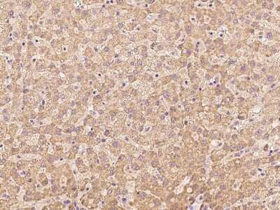 Immunohistochemistry-Paraffin: CCDC67 Antibody [NBP2-98665]