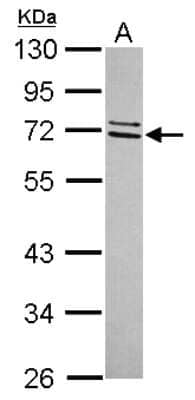 Western Blot: CCDC67 Antibody [NBP2-15751]