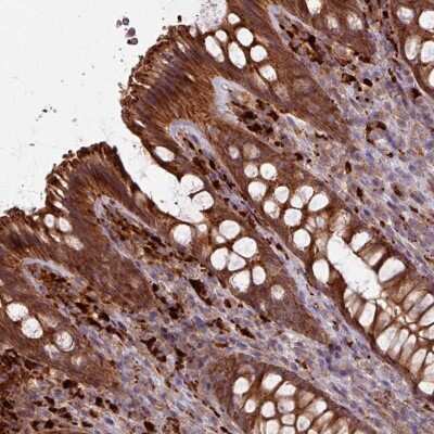 Immunohistochemistry: CCDC68 Antibody [NBP2-47520]
