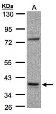 Western Blot: CCDC68 Antibody [NBP1-31622]