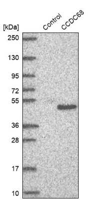 Western Blot: CCDC68 Antibody [NBP2-47520]