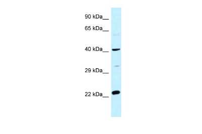 Western Blot: CCDC68 Antibody [NBP2-87151]