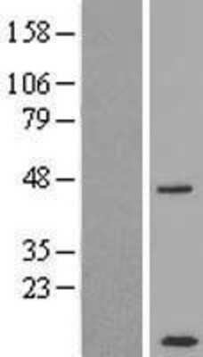 Western Blot: CCDC68 Overexpression Lysate [NBP2-09693]