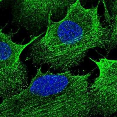 Immunocytochemistry/ Immunofluorescence: CCDC69 Antibody [NBP2-55589]