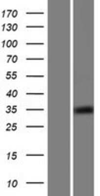 Western Blot: CCDC69 Overexpression Lysate [NBP2-07147]