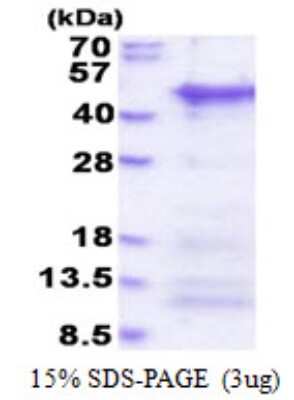 SDS-PAGE: Recombinant Human CCDC69 His Protein [NBP2-51589]