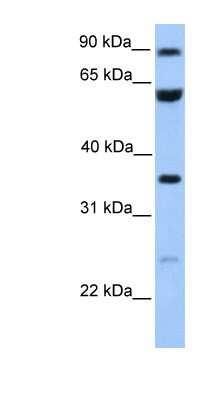 Western Blot: CCDC7 Antibody [NBP1-56757]