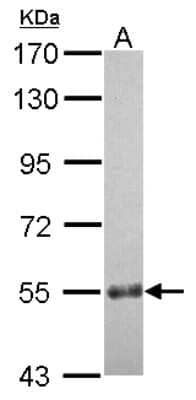 Western Blot: CCDC7 Antibody [NBP2-15753]